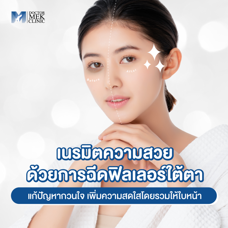 เนรมิตความสวยด้วยการฉีดฟิลเลอร์ใต้ตา  แก้ปัญหากวนใจ เพิ่มความสดใสโดยรวมให้ใบหน้า